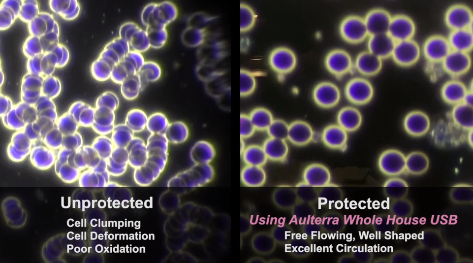 Live blood cells showing damage caused by EMFs and healthy protected cells when using Aulterra EMF Neutralizer products
